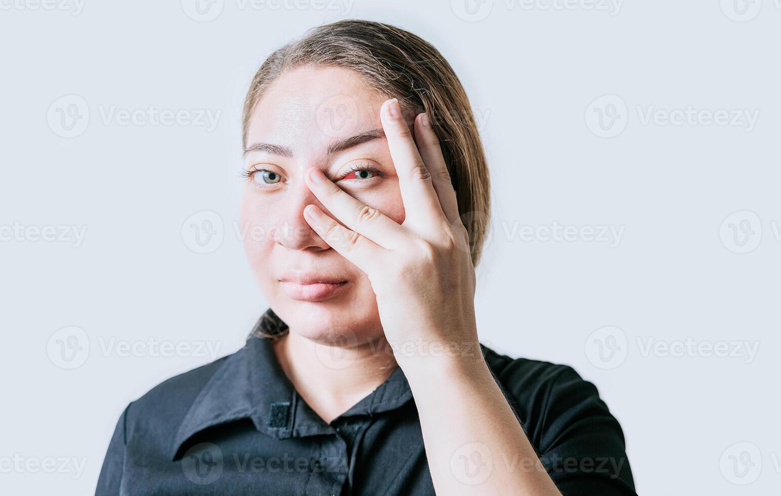 Person with irritated eyes. People with eye pain isolated. woman with conjunctivitis on white background. Close up of girl with eye strain photo