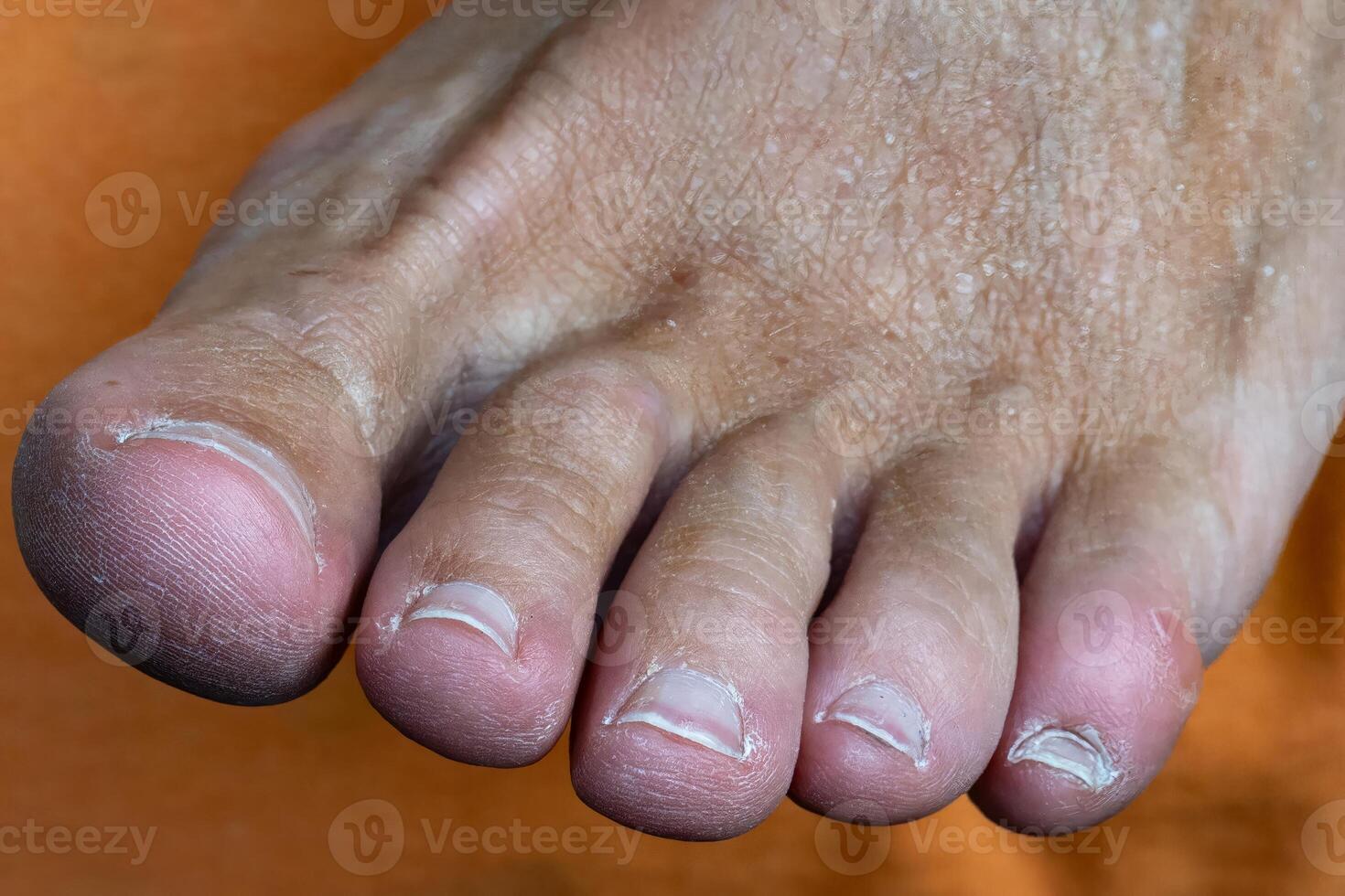toes on a human foot photo