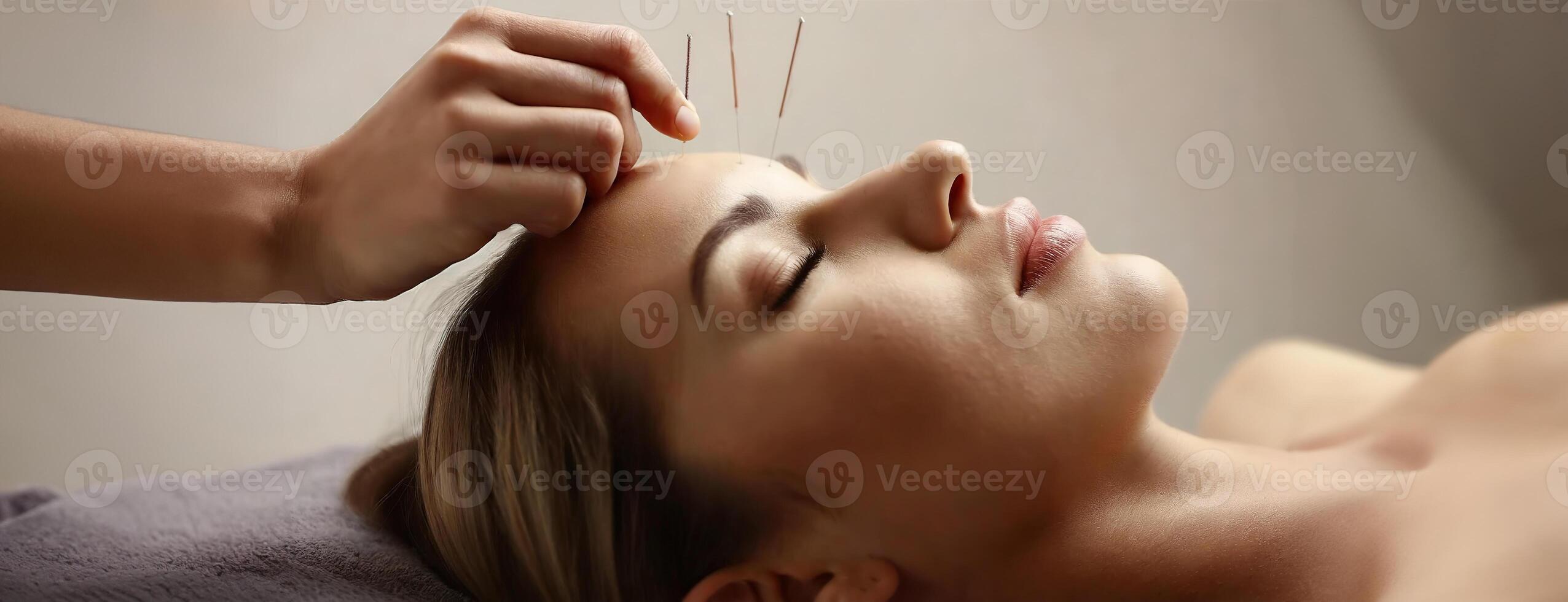 AI Generated Woman undergoing acupuncture therapy procedure on facial skin in spa salon. Doctor hand with a needle near a girl face. photo