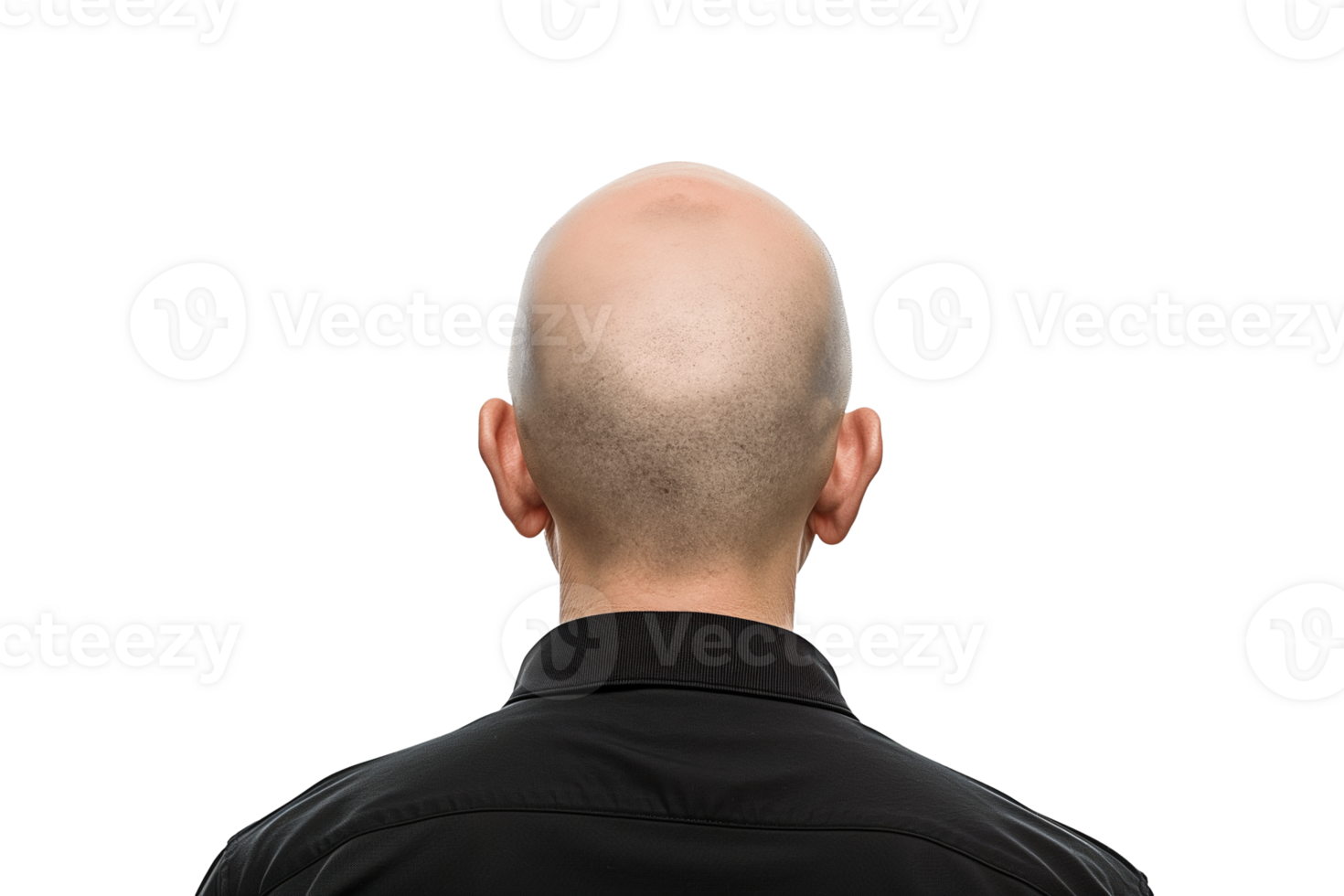 AI generated Baldness Revealed, Rear Head Close Up png
