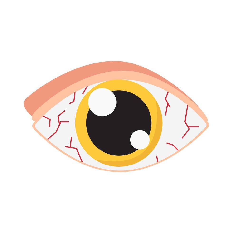 ojo alergia ilustración vector