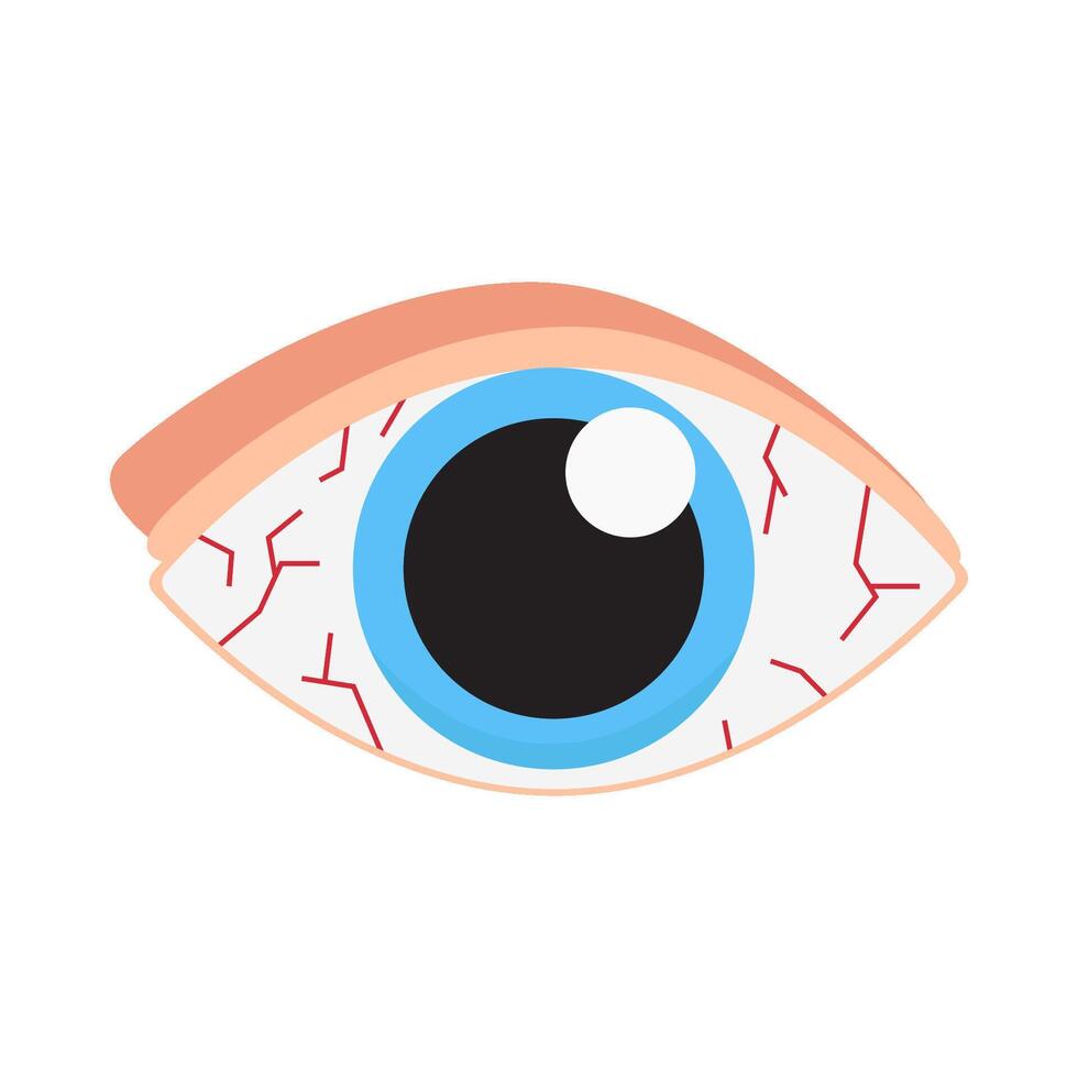 eye alergy illustration vector