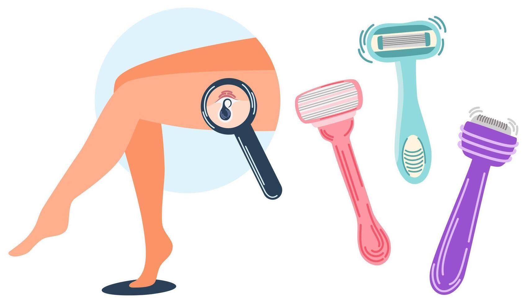 Ingrown hair. Inflamed follicle. Shaving concept. Different razors and cream make female legs silky. Hygiene and beauty everyday procedure. Vector illustration with problems after depilation.