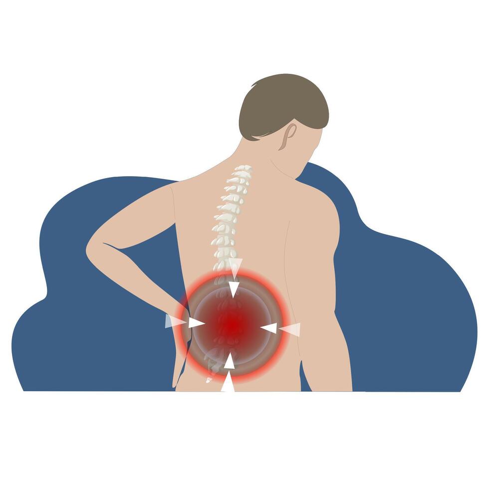 Pain in back, stretching tension or protrusion, herniated disc. Vector pain point in skeleton, body ache, vector injury spine, vertebrae backache, hurt and painful spinal nerve illustration