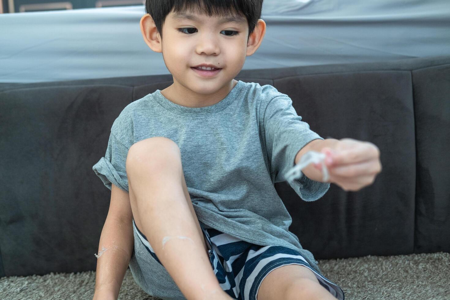 pequeño asiático Niños manos peladura apagado seco piel en su brazo. piel problemas. foto