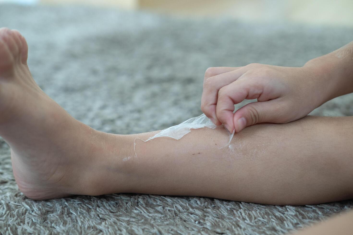 Little Asian boy's hands peeling off dry skin on his legs. Skin problems. photo