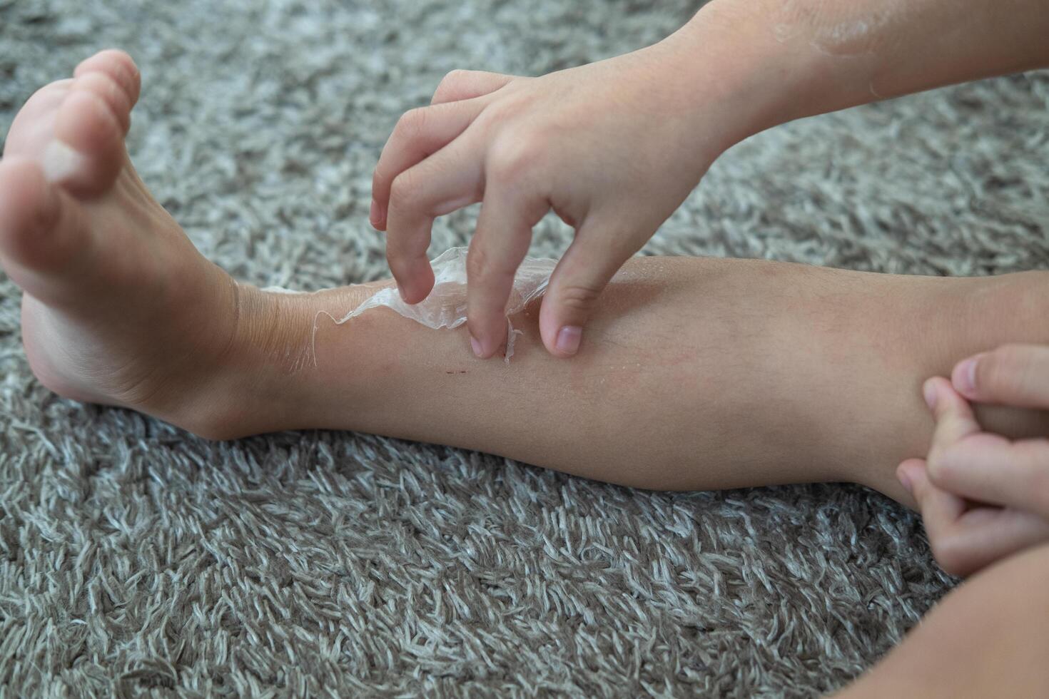 Little Asian boy's hands peeling off dry skin on his legs. Skin problems. photo