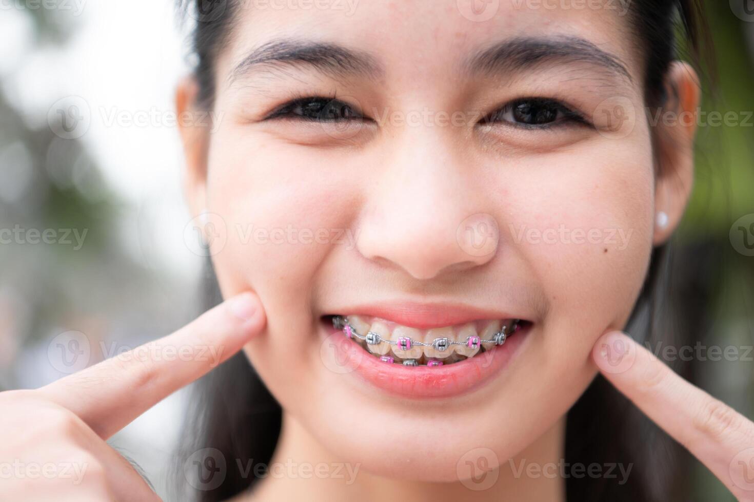 Portrait of a young asian woman with braces on her teeth photo