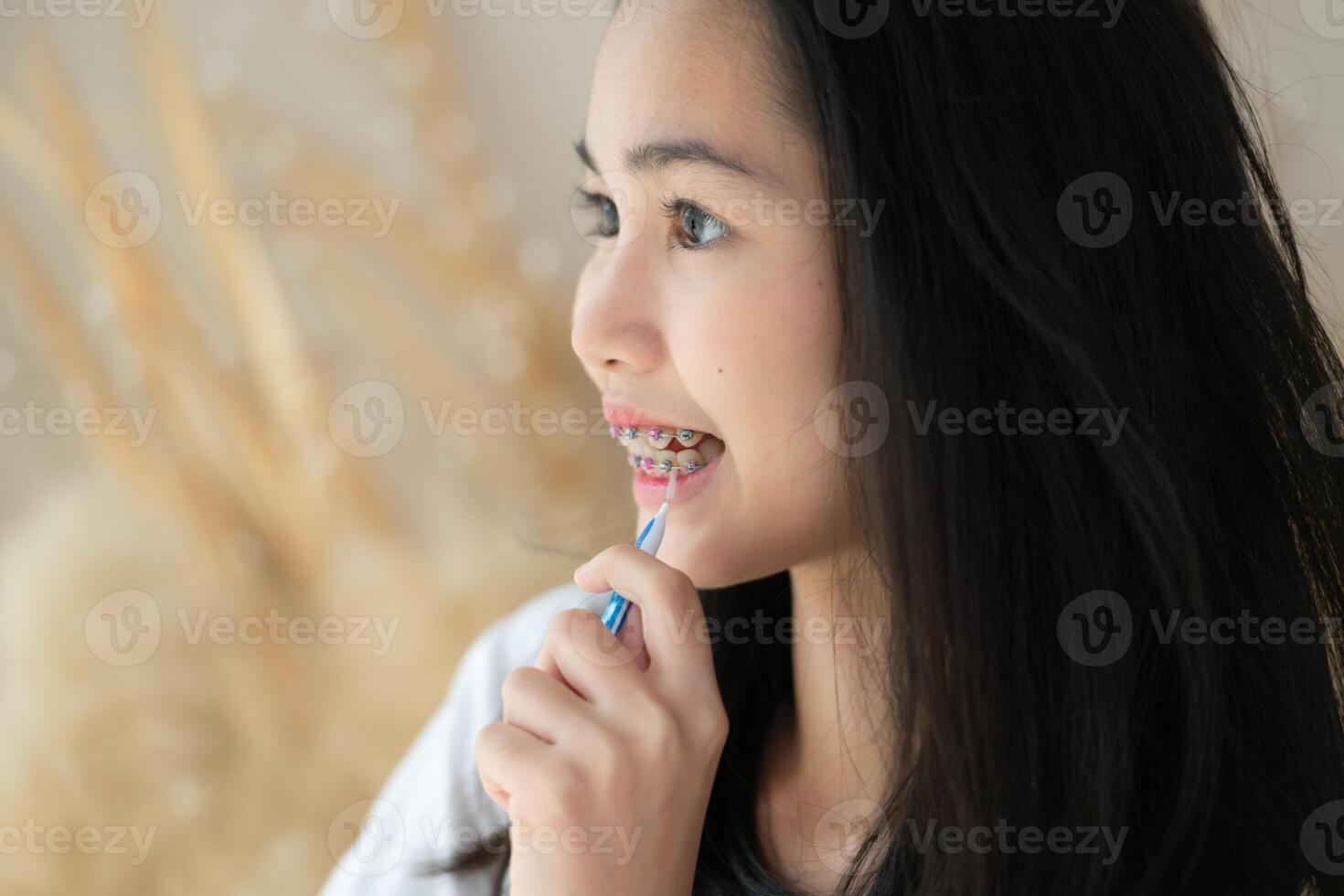 Portrait of a young asian woman with braces on her teeth photo