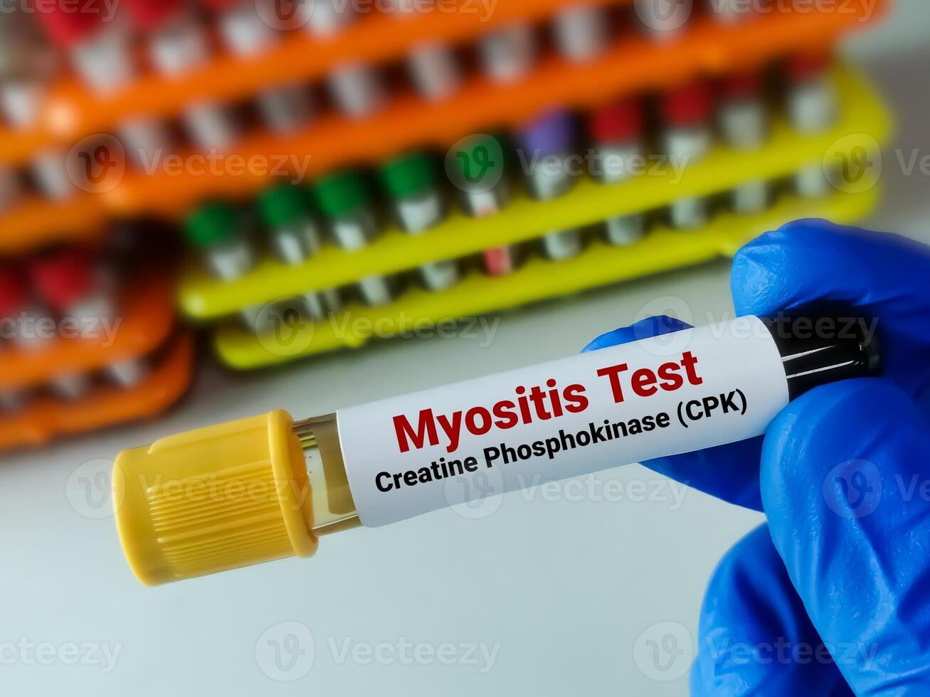 Biochemist holding blood sample for Myositis test. Creatinine Phosphokinase. Creatinine Kinase photo