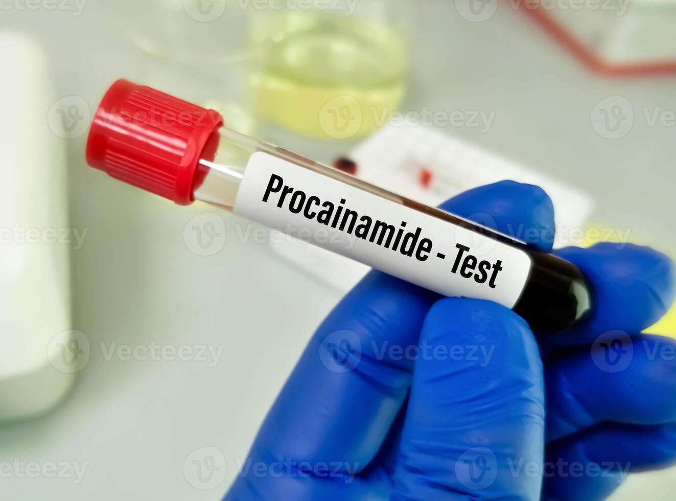 Blood sample for Procainamide test, to set therapeutic range for patient. photo