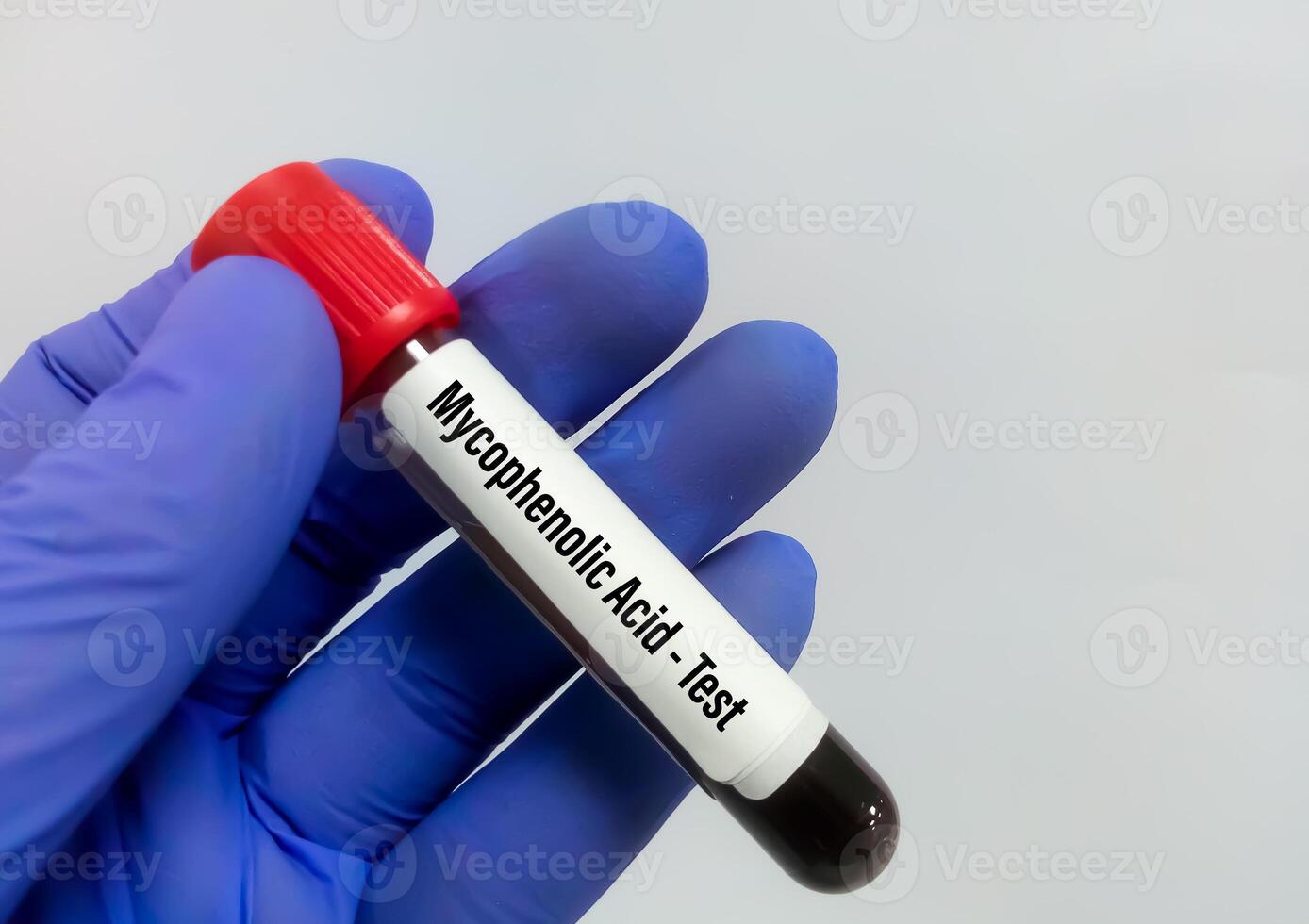 Blood sample for Mycophenolic acid test photo