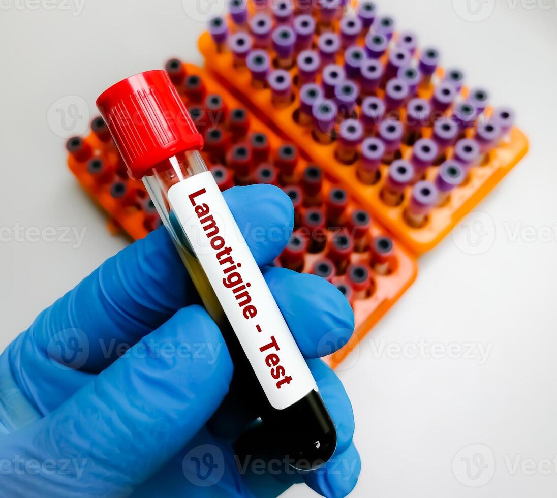 Blood sample for Lamotrigine test. Test done to Monitor the concentration of lamotrigine in blood for adjusting therapeutic dose. Anticonvulsant drug, bipolar disorder. photo