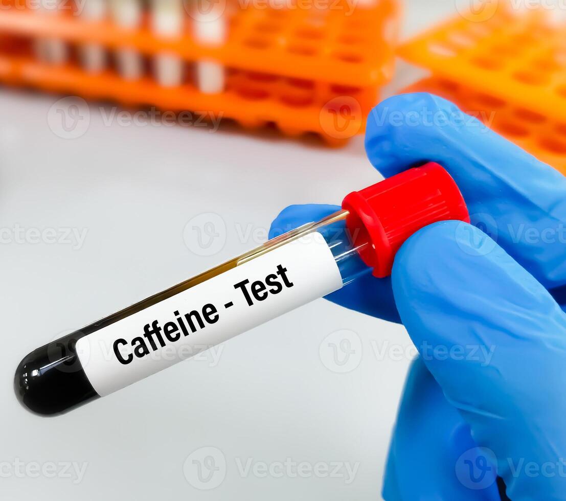 Scientist holding sample for Caffeine blood test photo