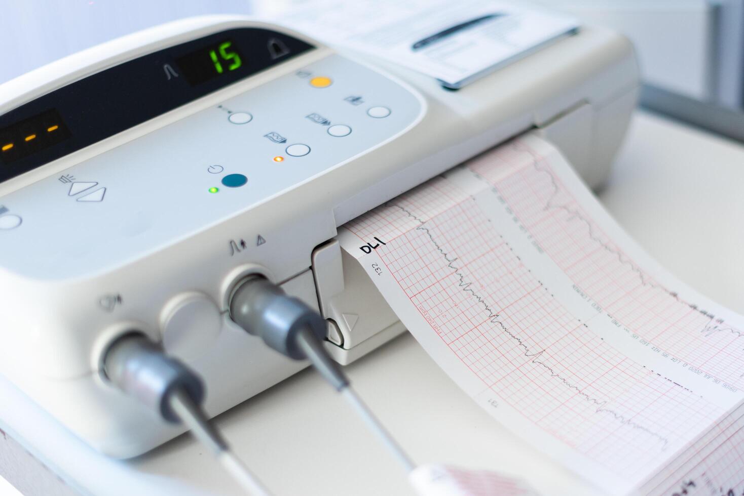 Cardiogram of the baby before birth photo