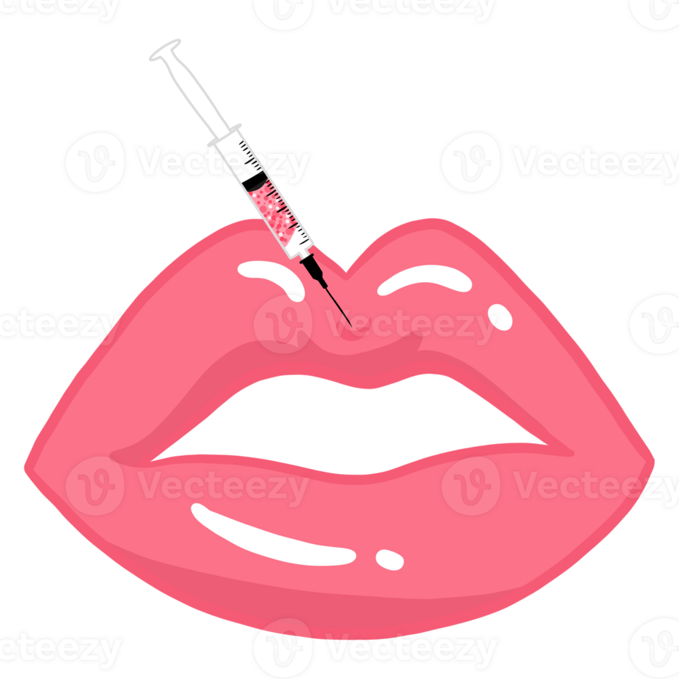 vrouw lippen injectie procedure png