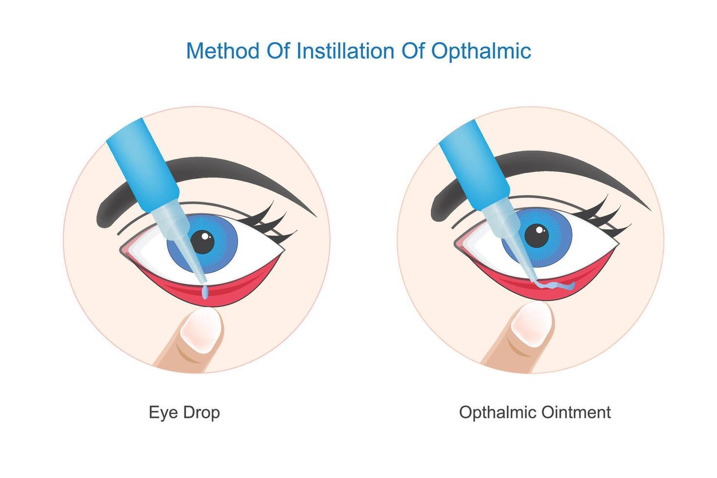 Method of instillation of opthalmic. Correct use of eye drops and opthalmic ointment.Concept of eye treatment, eye inflammation, eye fatigue, care, vision and health.vector illustration. vector