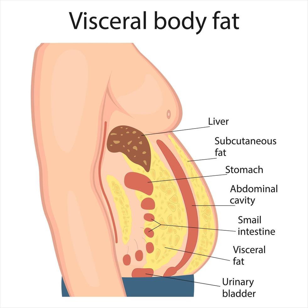 Visceral fat and subcutaneous fat accumulate around organs. Medicine and health diagram about belly fat. vector