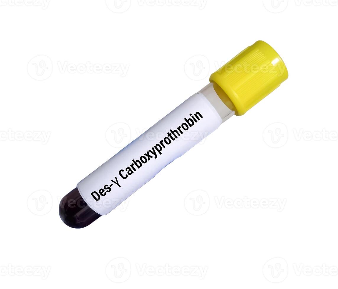 Blood sample for Des gamma carboxy prothrombin or DCP test, to help evaluate whether treatment for one type of liver cancer, hepatocellular carcinoma or HCC. white background. photo