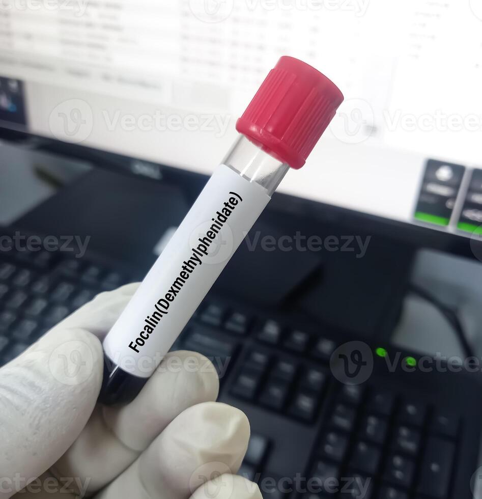Blood sample for Methylphenidate or Retalin test. Stimulant used for attention deficit hyperactivity disorder or ADHD. photo