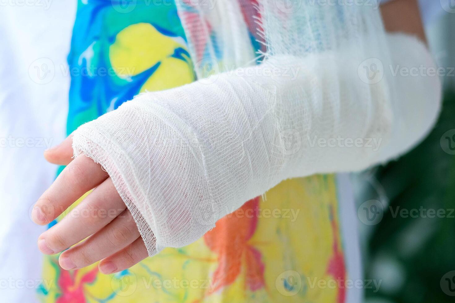 Close-up of a broken arm of a child in a cast. The girl holds her hand bent photo