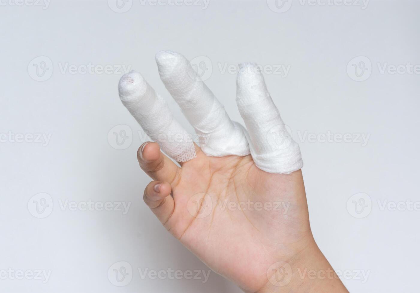All three fingers were injured. Was wrapped in gauze dressing. Prevent the wound contact with dirt. photo