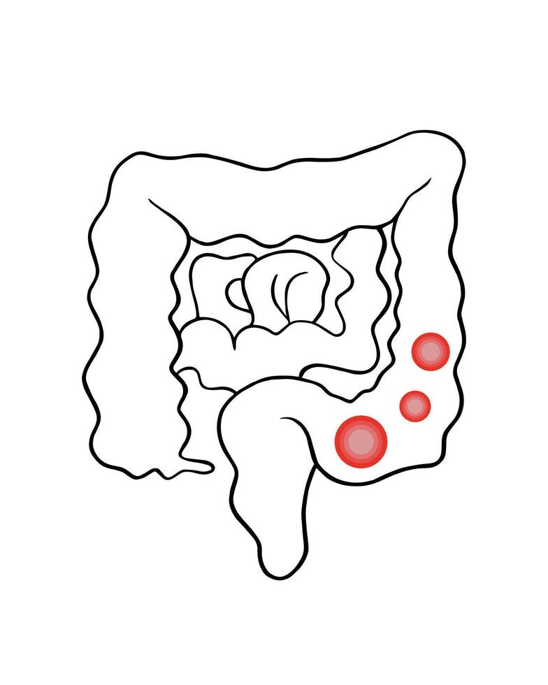 Vector illustration of human intestine.Constipation. Intestinal problems.