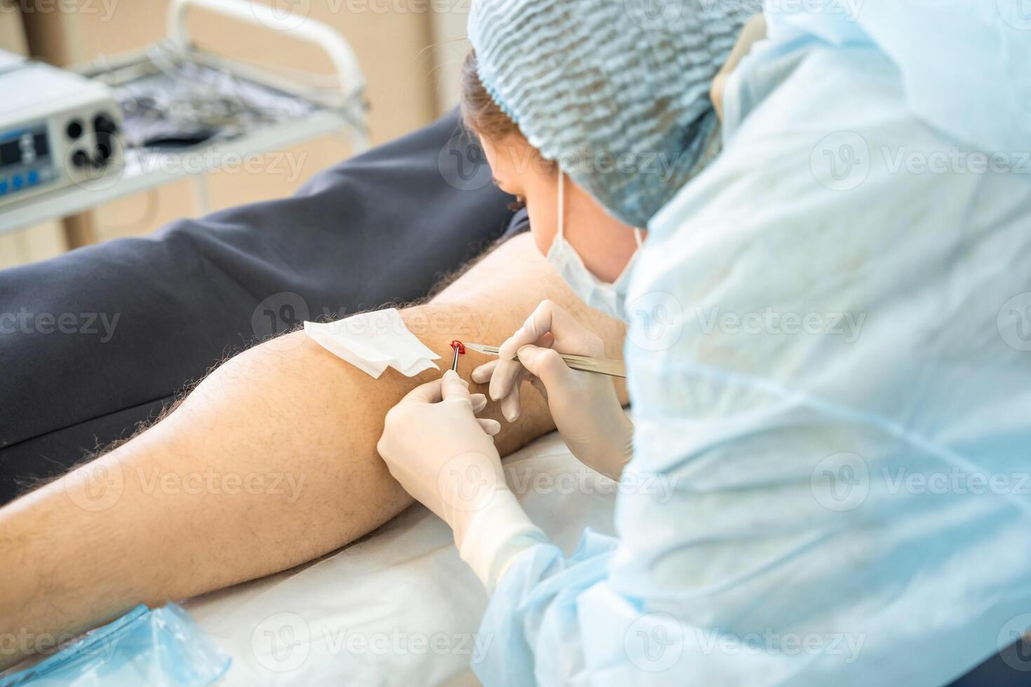 Dermatologist surgeon removes skin diseases with scalpel and tweezers, operation process photo