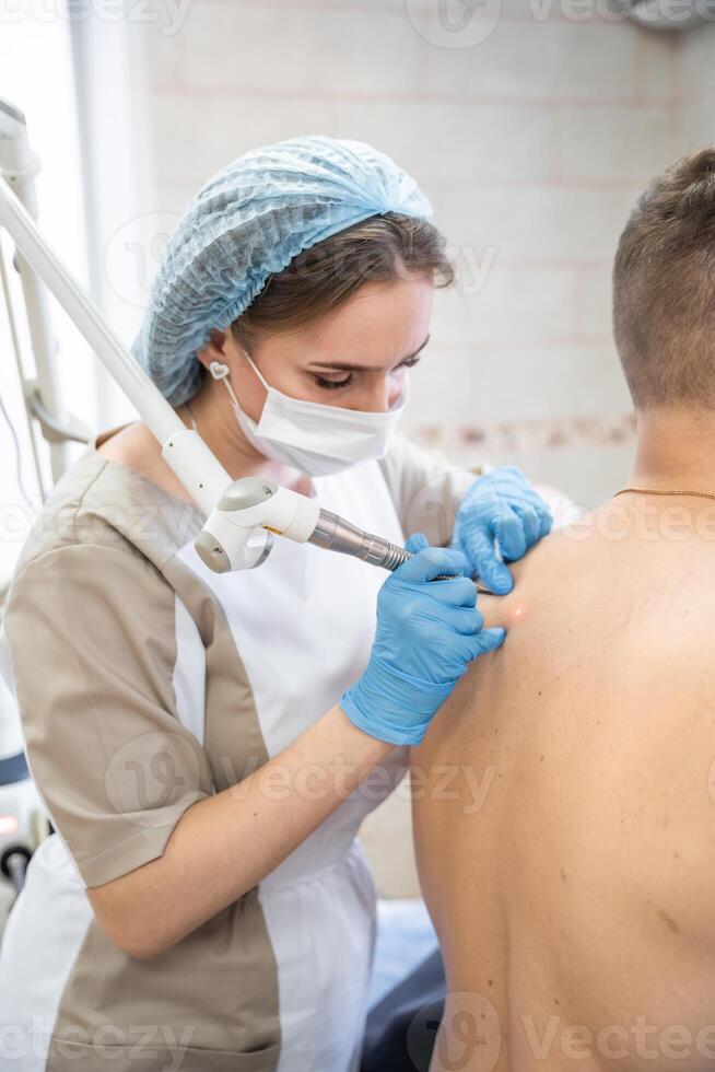 Dermatologist removes skin tumors with a laser, the process of removing skin diseases photo
