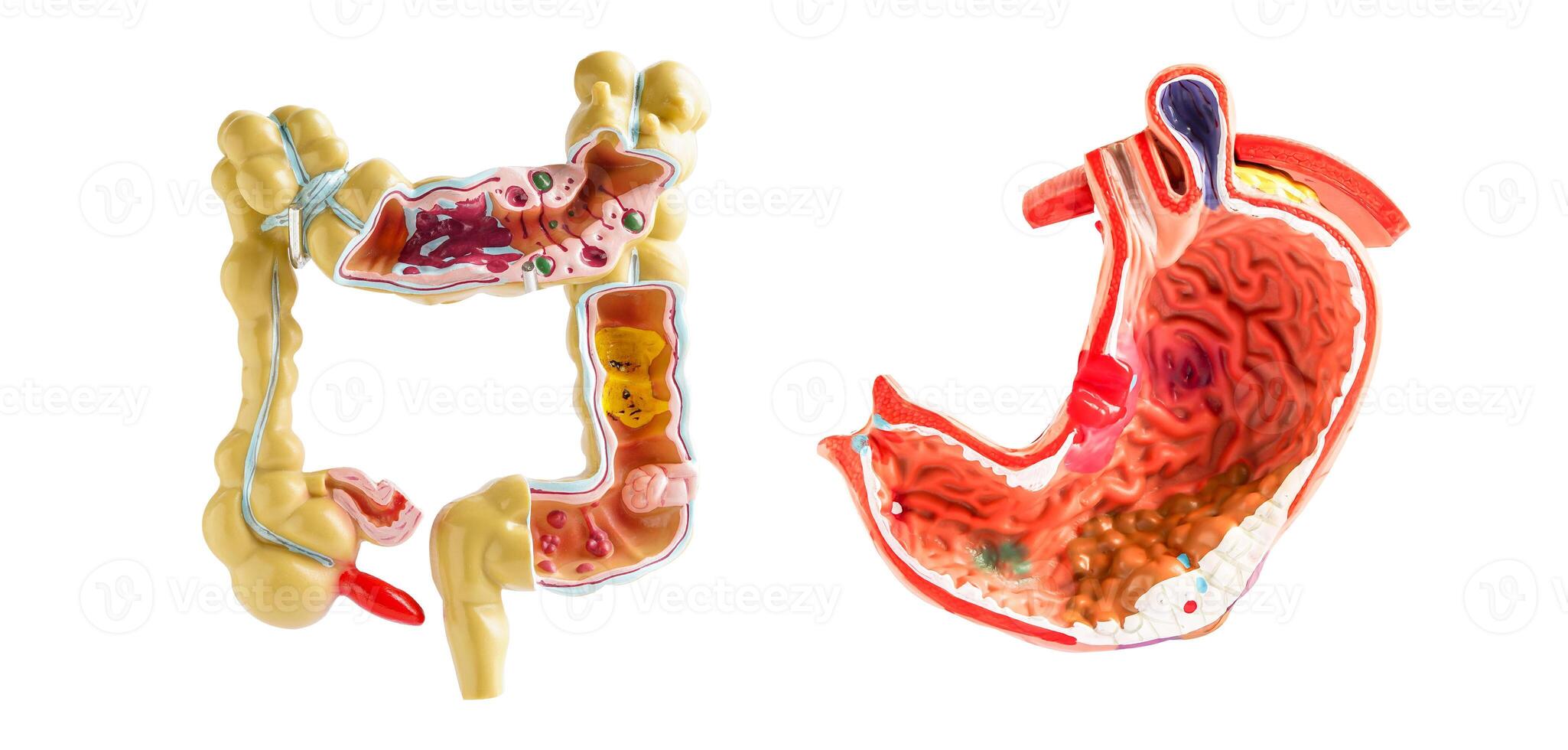 intestino y estómago modelo aislado en blanco fondo, médico participación anatomía modelo para estudiar diagnóstico y tratamiento en hospital. foto
