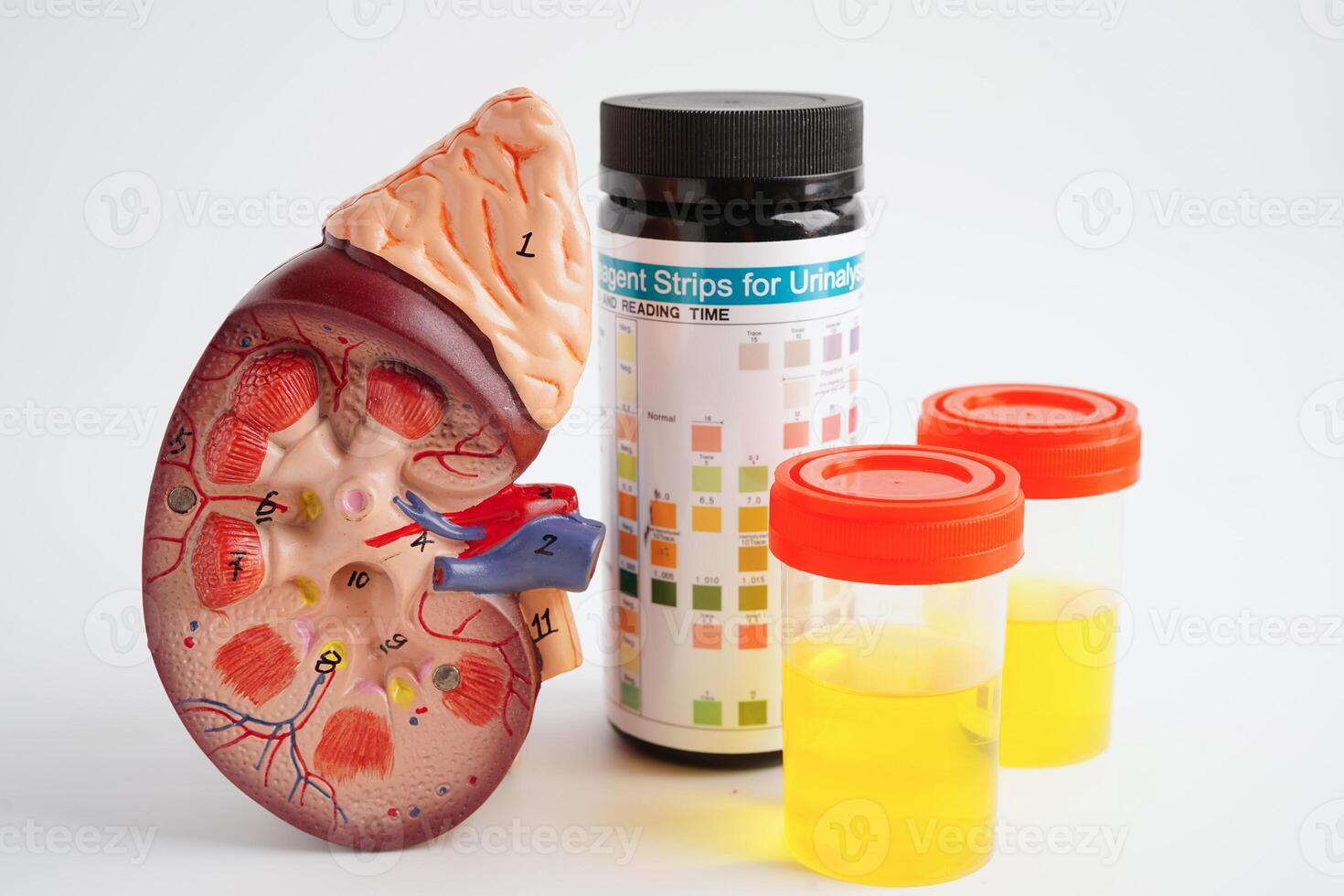 análisis de orina, riñón y orina taza para cheque salud examen en laboratorio. foto