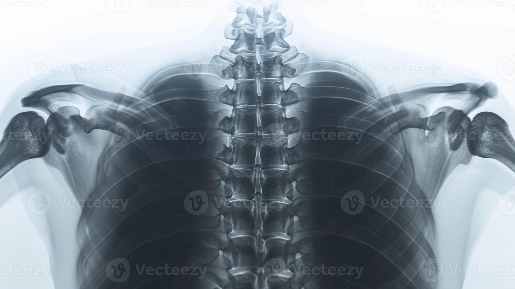 AI generated Thoracic spine radiography with rib articulations and costotransverse joints. photo