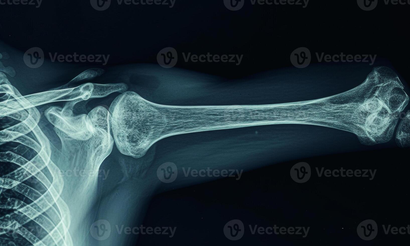 AI generated Radiograph of the shoulder anatomy with clavicle, scapula, and humerus photo