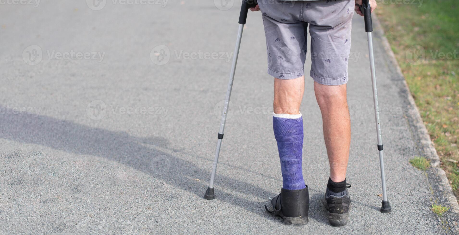 man with a broken leg walks down the street, his left leg is in a cast, the man moves with the help of crutches photo