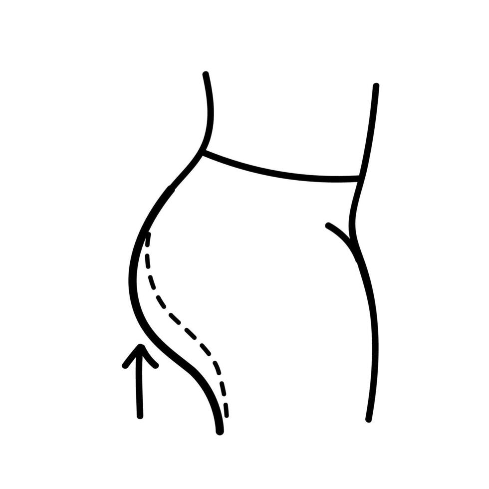 Women beauty face plastic surgery. Buttock fat liposuction. Body contouring. Hand drawn vector illustration. Editable line stroke