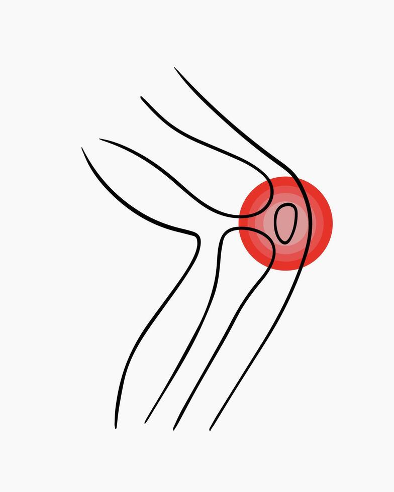 Vector isolated illustration of knee pain. Contour drawing of a human leg with pain in the joints.