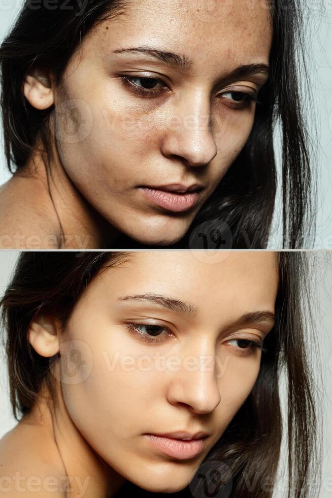 Before and after cosmetic operation. photo