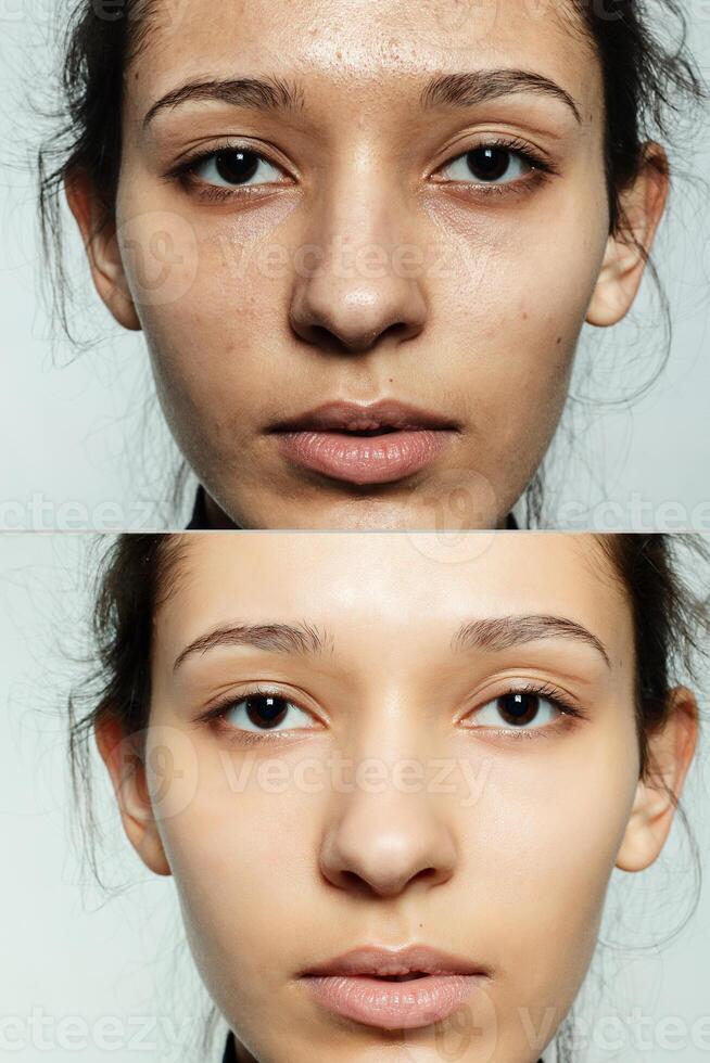 Before and after cosmetic operation. photo