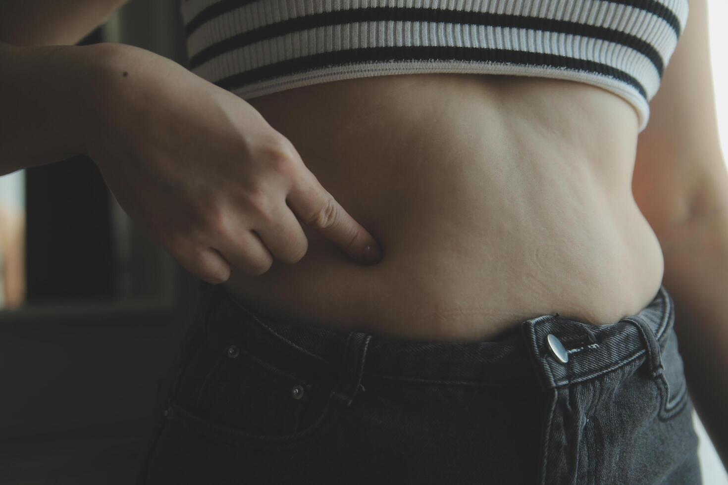 Women body fat belly. Obese woman hand holding excessive belly fat. diet lifestyle concept to reduce belly and shape up healthy stomach muscle. photo
