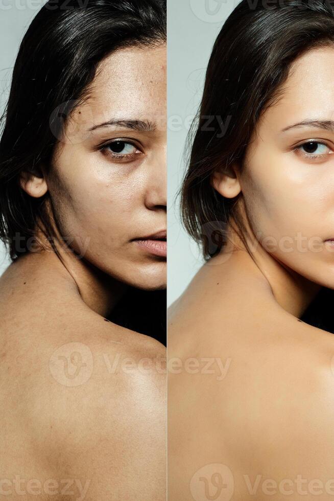Before and after cosmetic operation. photo