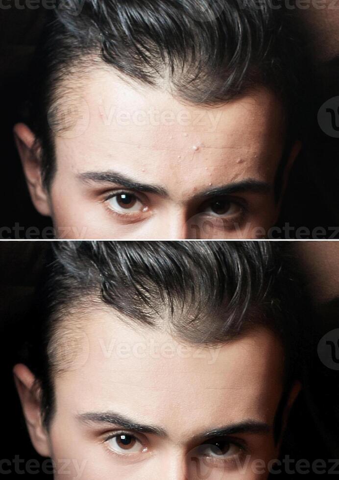 antes de y después cosmético operación. joven hombre retrato foto