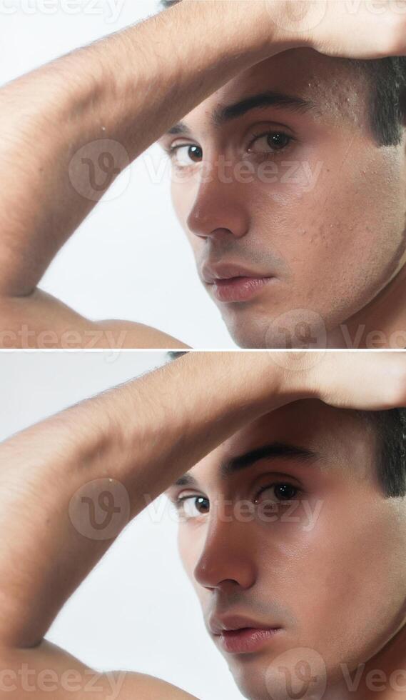 antes de y después cosmético operación. joven hombre retrato foto