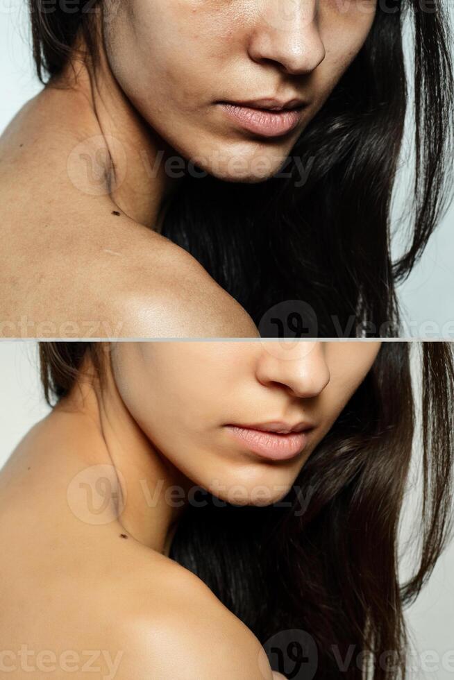 Before and after cosmetic operation. photo