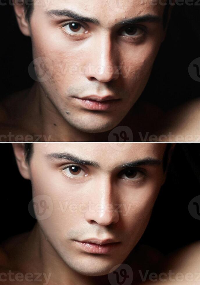 Before and after cosmetic operation. Young man portrait photo