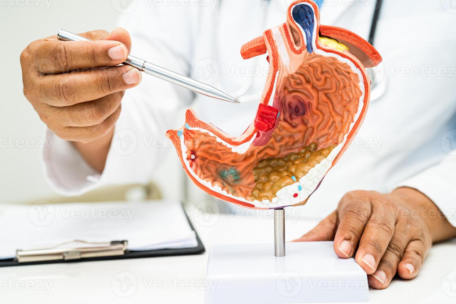 Stomach disease, doctor with anatomy model for study diagnosis and treatment in hospital. photo