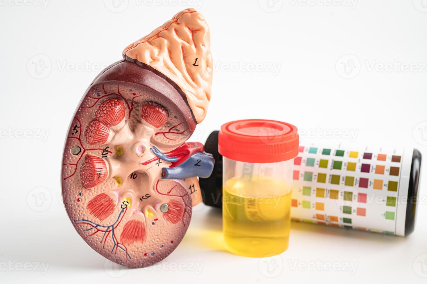 Urinalysis, Kidney model and urine cup with reagent strip pH paper test and comparison chart in laboratory. photo