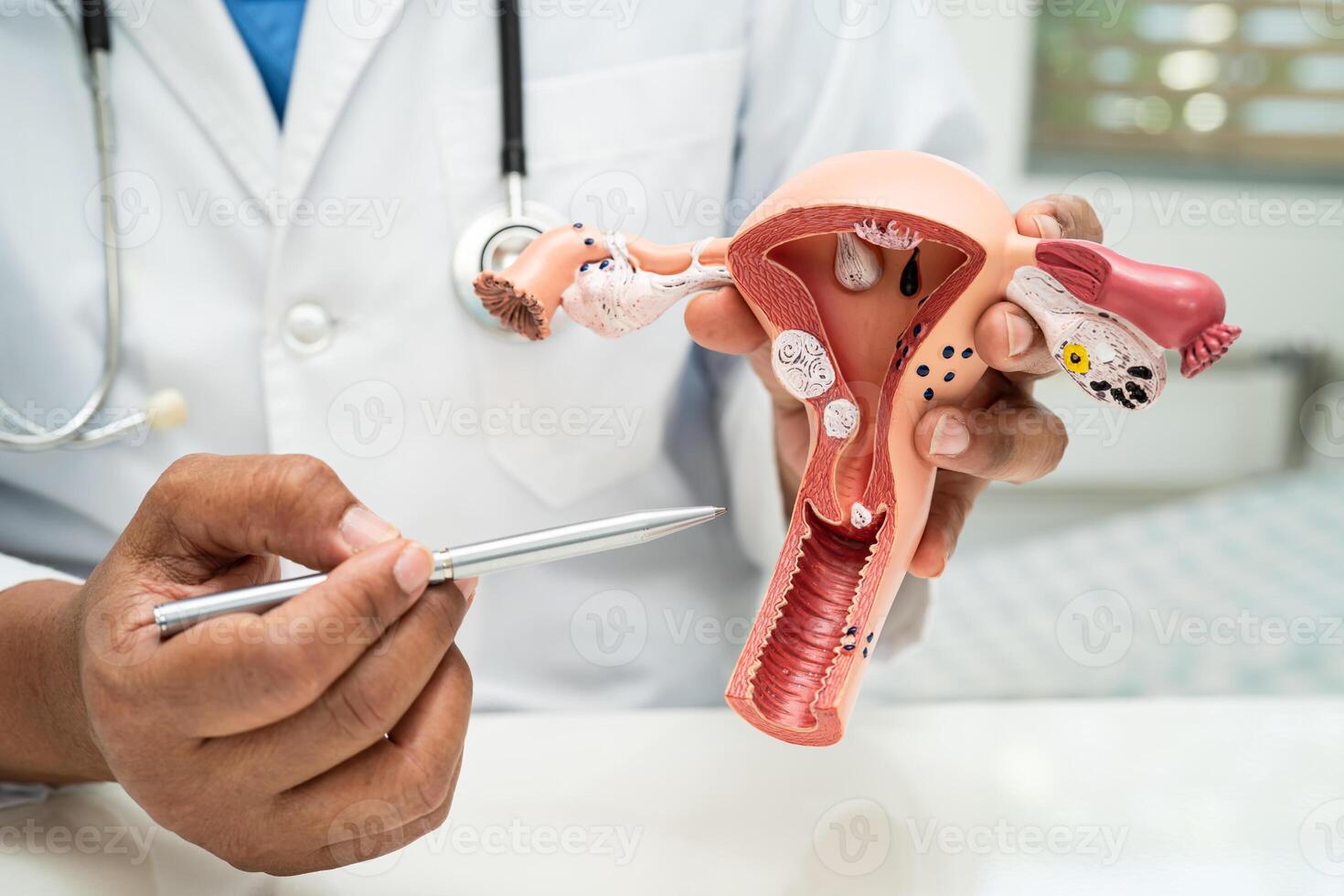 útero, médico con anatomía modelo para estudiar diagnóstico y tratamiento en hospital. foto