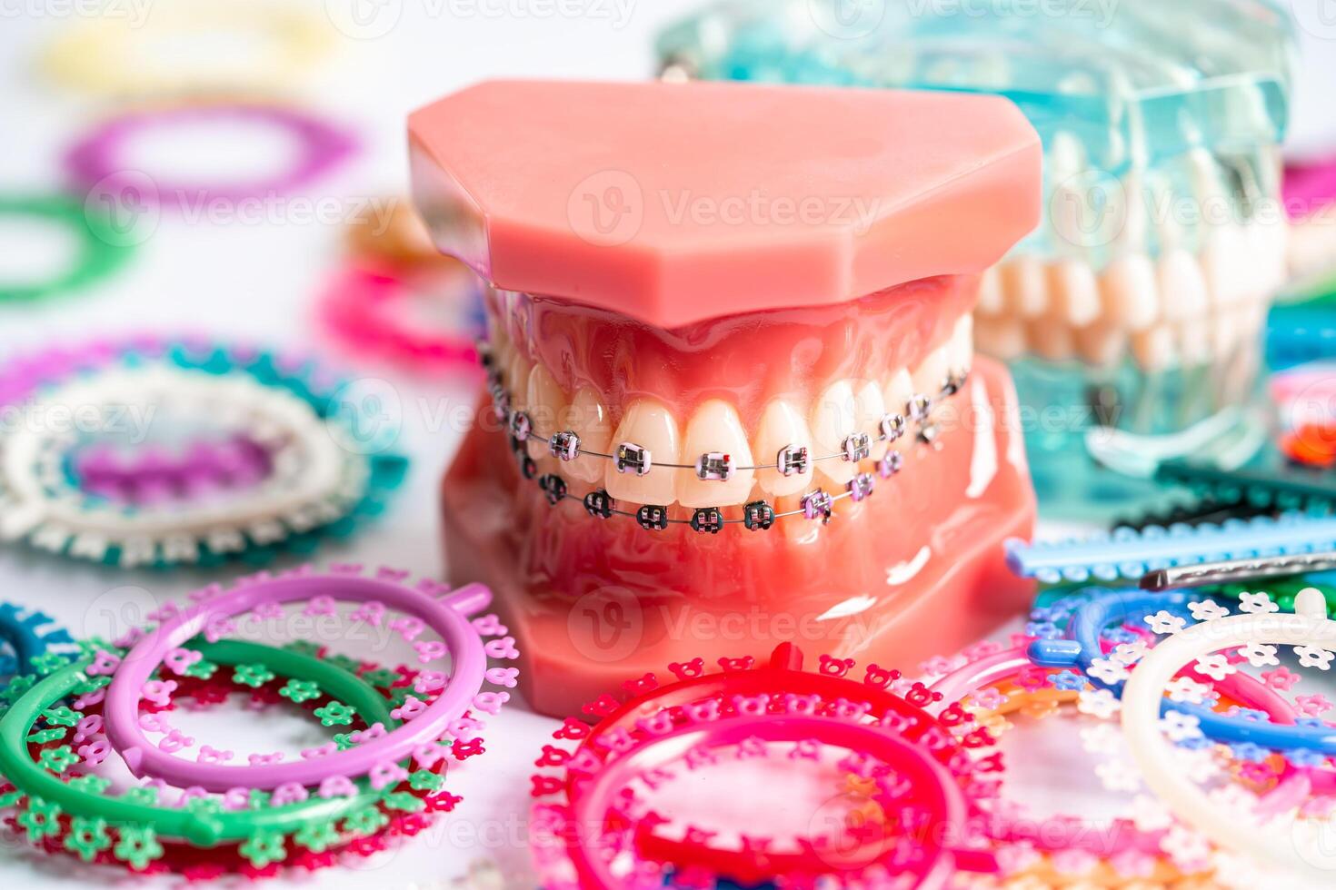 Orthodontic ligatures rings and ties, elastic rubber bands on orthodontic braces, model for dentist studying about dentistry. photo