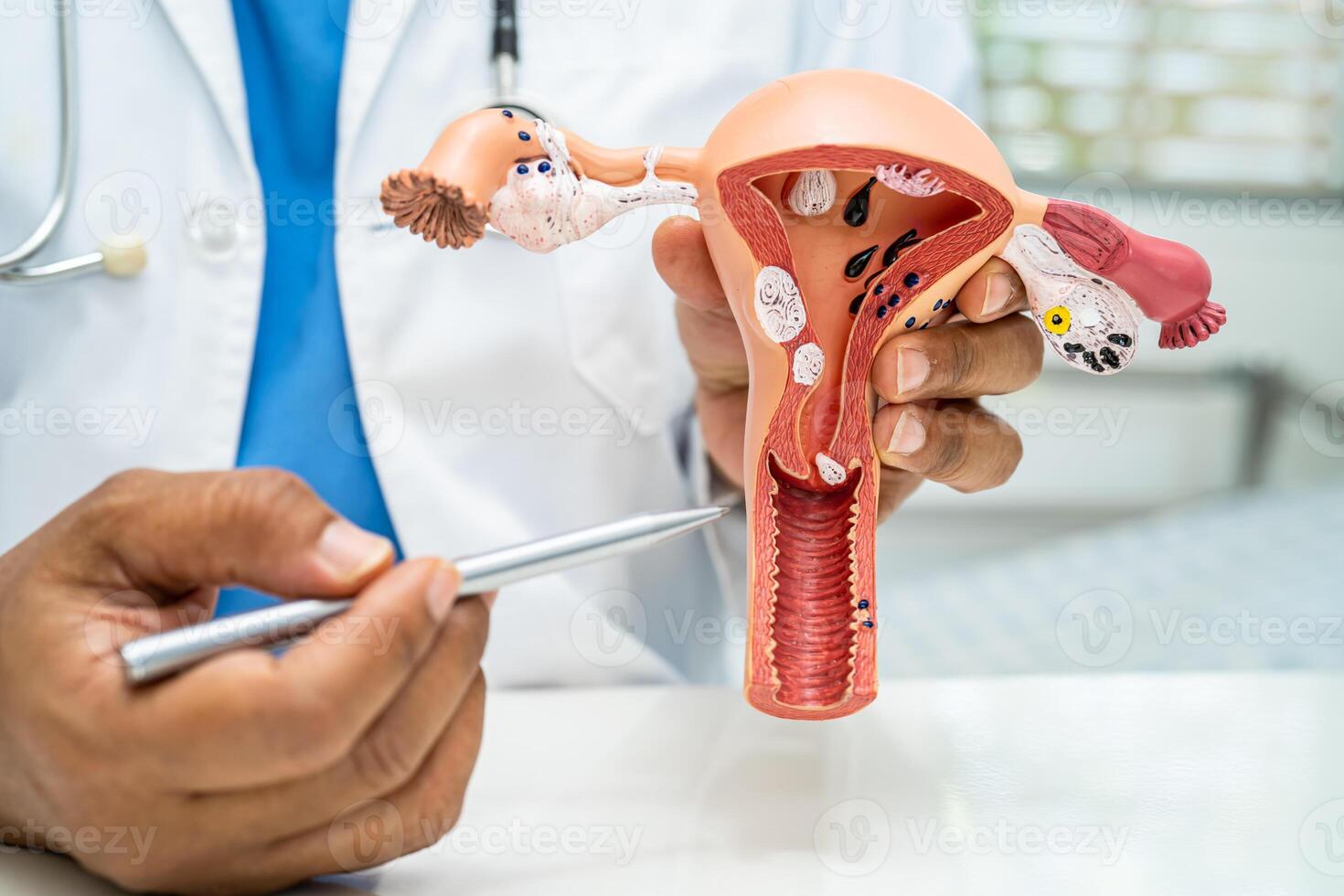 útero, médico con anatomía modelo para estudiar diagnóstico y tratamiento en hospital. foto