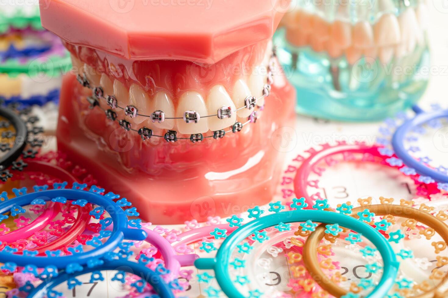 Orthodontic ligatures rings and ties, elastic rubber bands on orthodontic braces, model for dentist studying about dentistry. photo